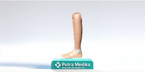 Kaki Palsu Lokal Cirebon