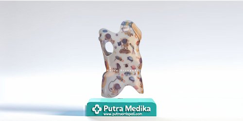 Munster Scoliosis Brace