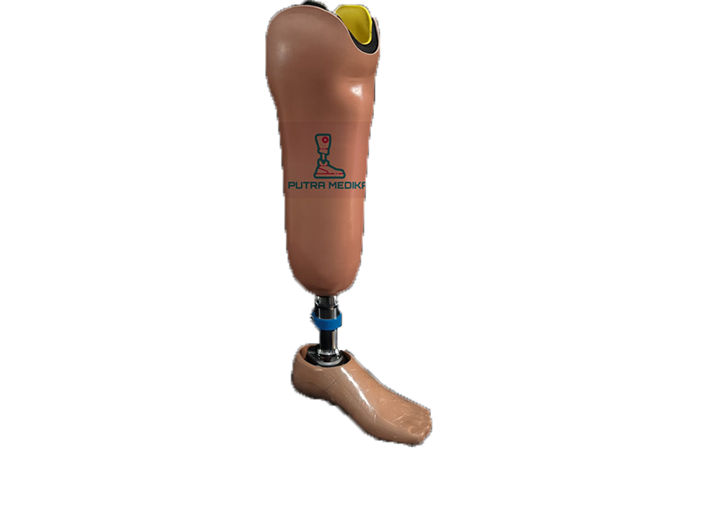 Hip Disarticulation Prosthesis