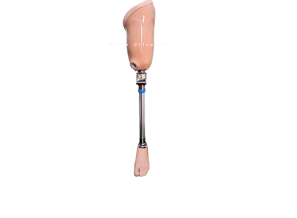 Hip Disarticulation Prosthesis