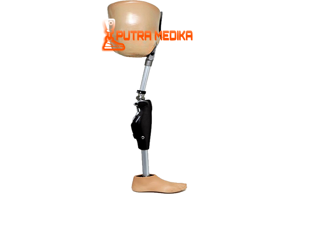 Hip Disarticulation Prosthesis