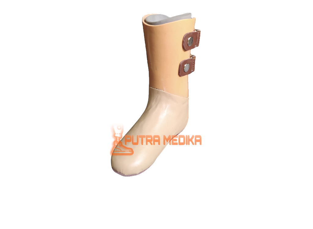 Hip Disarticulation Prosthesis
