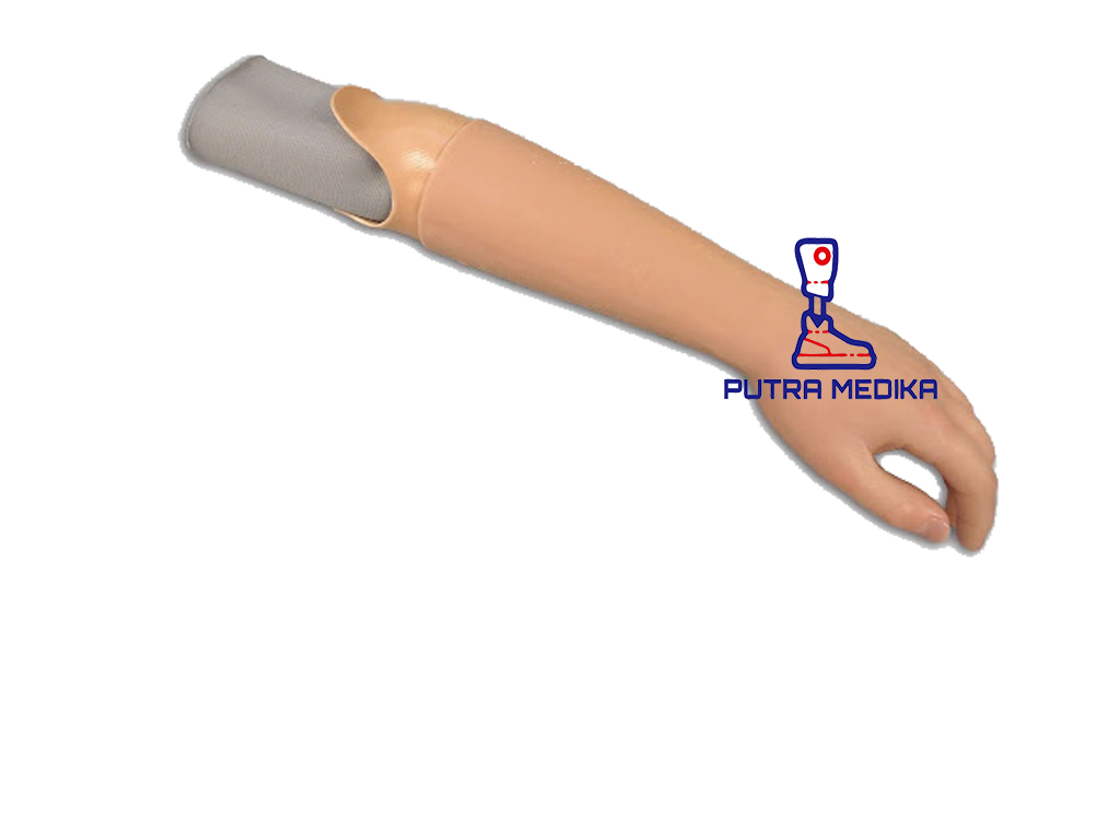 Hip Disarticulation Prosthesis